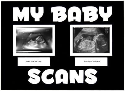 BabyRice nova crna & amp; Bijela beba 1. & 2. skenira ultrazvučni okvir za fotografije - ručni rad